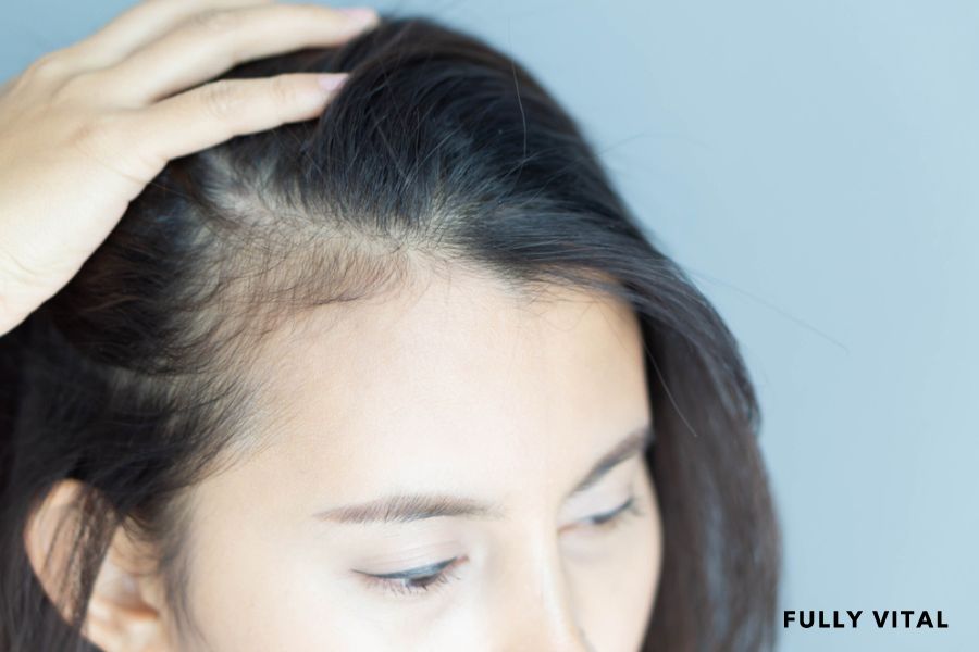 Woman thinking about her receding hairline