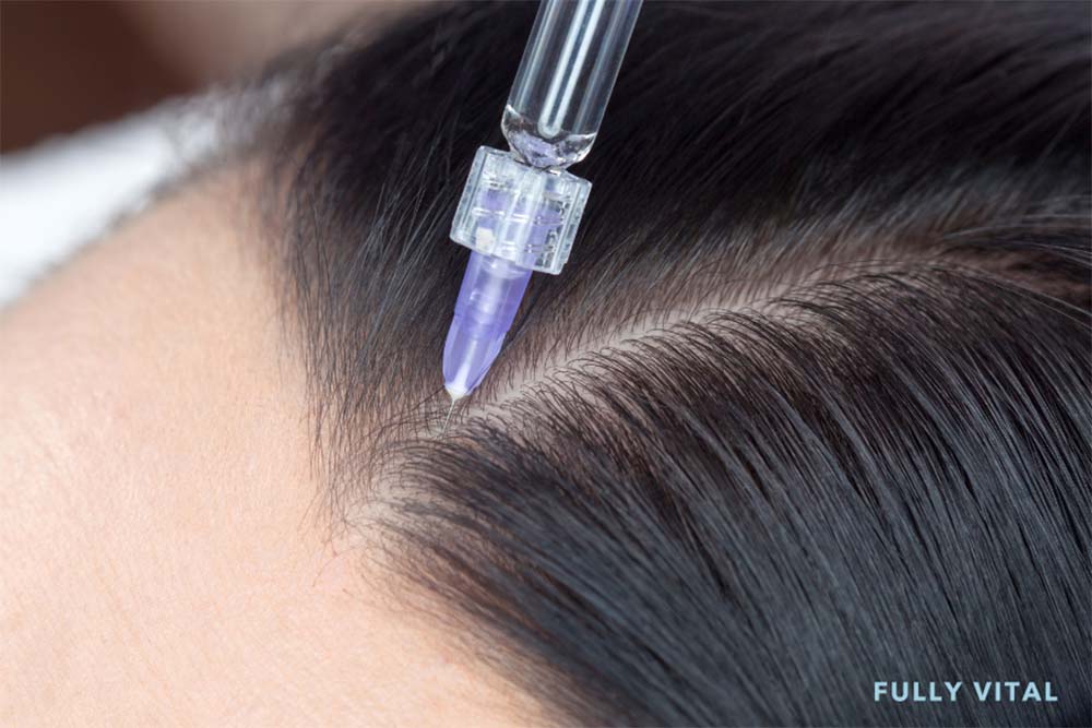 Mesotherapy close up look