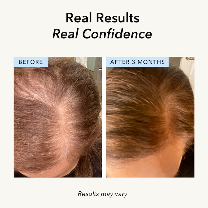 Thick Hair Supplements (3-Pack) + 2 FREE Gifts AFFL