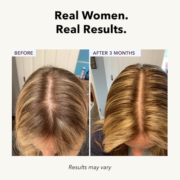 FullyVital Hair Growth Serum + FREE Silk Sleep Mask