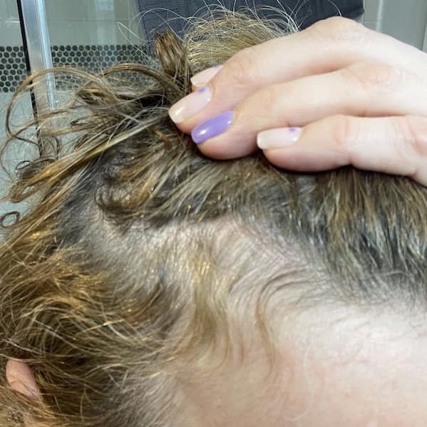 enhance hair growth serum results