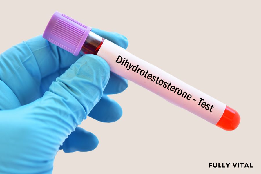dihydrotestosterone sample