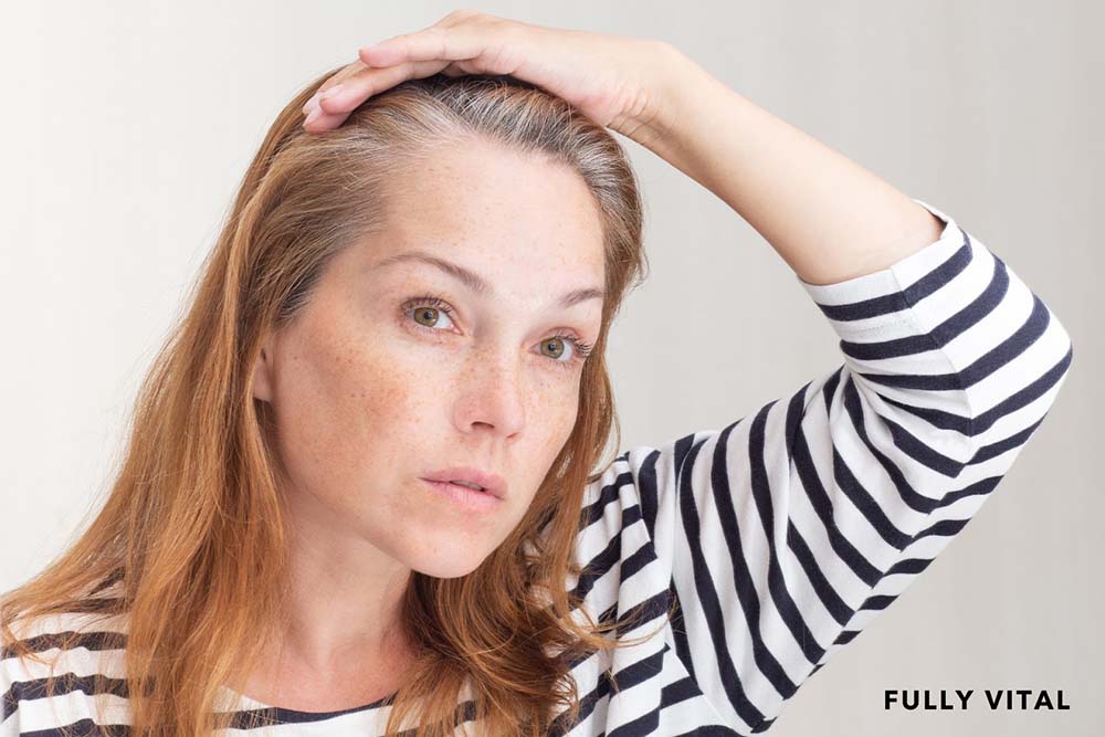 Middle age woman with frontal fibrosing alopecia