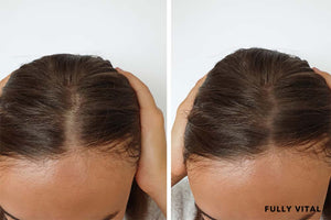 Pura D'or Vs. Fully Vital: Which Brand Offers Better Hair Growth Results?