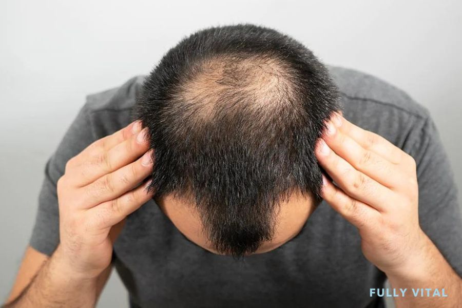Showing uneven hairline