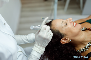 Performing microneedling