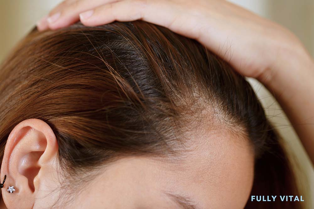 Derma roller for scalp
