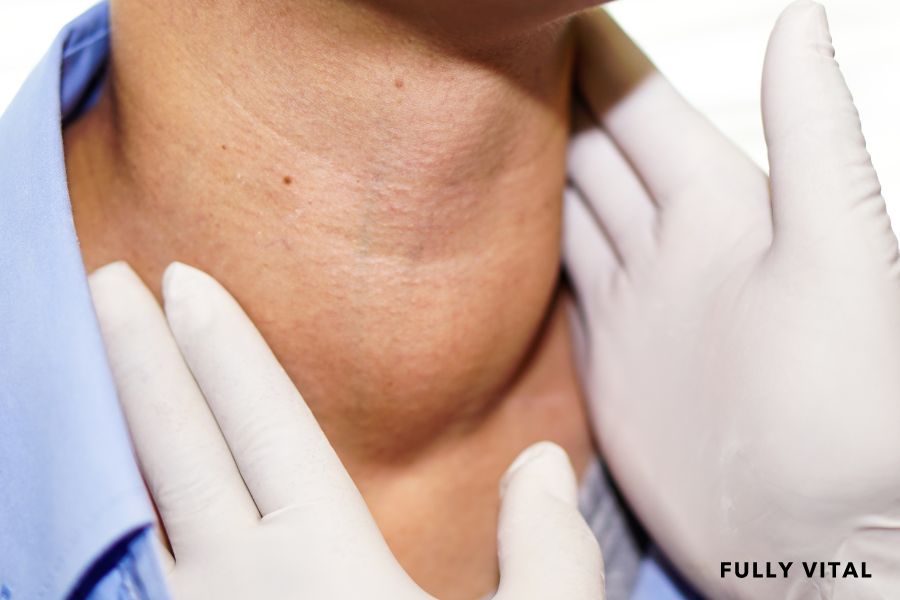  Woman suffering from hyperthyroidism