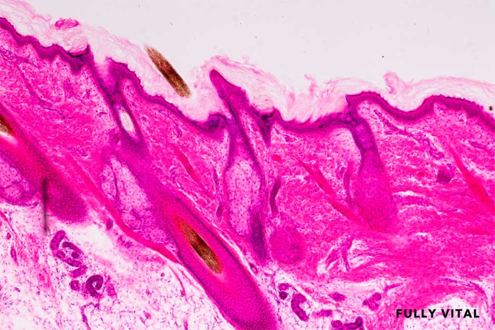 Scalp biopsy on a microscope