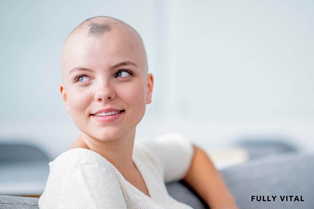 Smiling alopecia patient