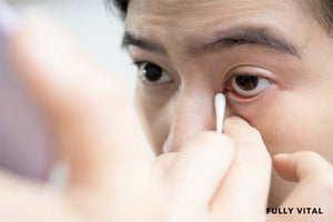 Cleaning eyes with trichiasis