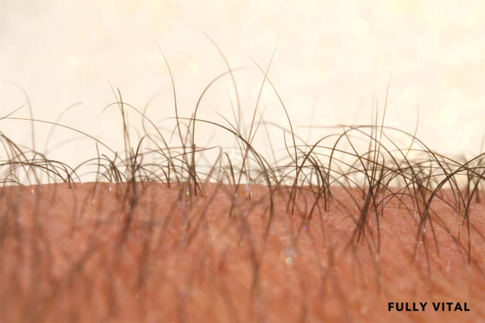 Vellus hair