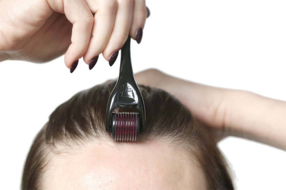 How To Use A Derma Roller For Hair Growth