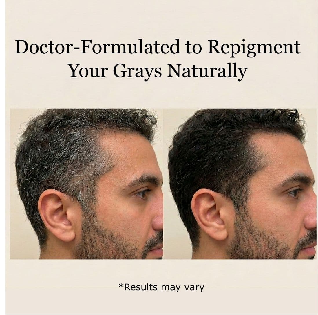 gray hair reversal results with anti gray serum