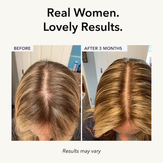 fully vital enhance hair growth results