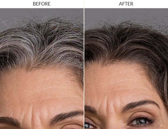 Woman's hair transitioning from gray to naturally darker, more pigmented strands after using FullyVital